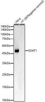 SOAT1 Rabbit Monoclonal Antibody