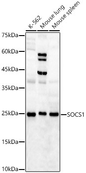 SOCS1 Rabbit Polyclonal Antibody