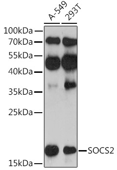 SOCS2 Rabbit Polyclonal Antibody