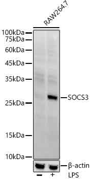SOCS3 Rabbit Monoclonal Antibody