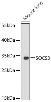 SOCS3 Rabbit Polyclonal Antibody