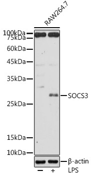 SOCS3 Rabbit Polyclonal Antibody