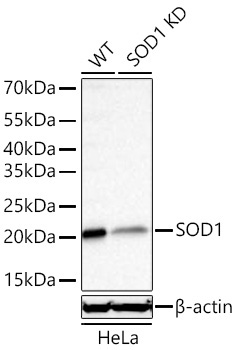 SOD1 Rabbit Monoclonal Antibody