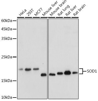SOD1 Rabbit Polyclonal Antibody