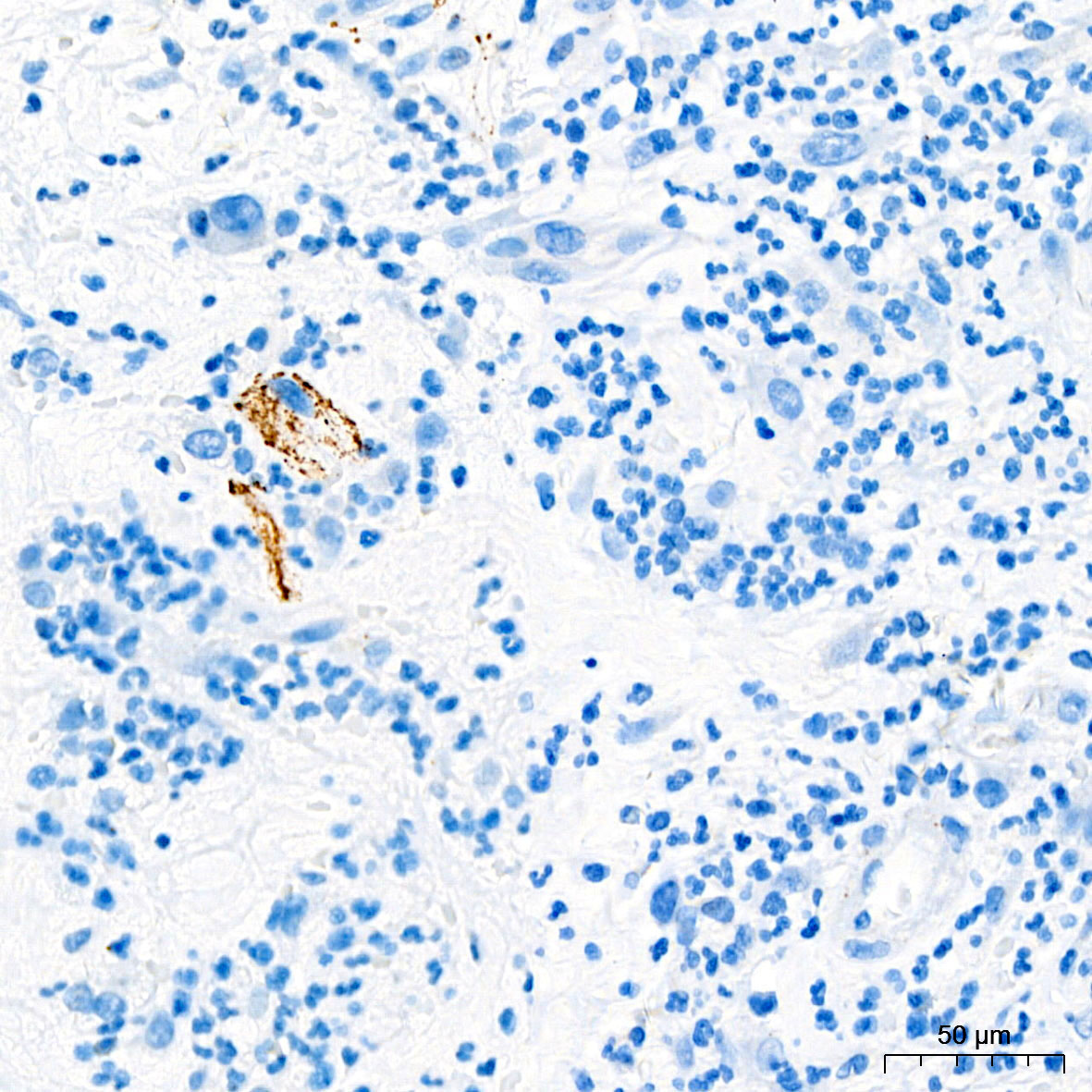Somatostatin (SST) Rabbit Monoclonal Antibody
