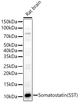 Somatostatin (SST) Rabbit Polyclonal Antibody