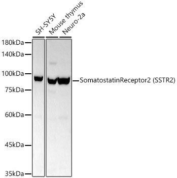 Somatostatin Receptor 2 (SSTR2) Rabbit Monoclonal Antibody