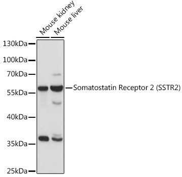 Somatostatin Receptor 2 (SSTR2) Rabbit Polyclonal Antibody