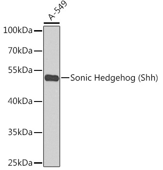 Sonic Hedgehog (Shh) Rabbit Polyclonal Antibody