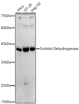 Sorbitol Dehydrogenase Rabbit Polyclonal Antibody