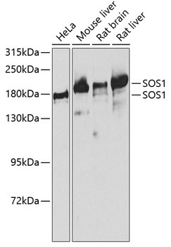 SOS1 Rabbit Polyclonal Antibody