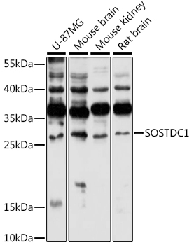 SOSTDC1 Rabbit Polyclonal Antibody