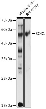 SOX1 Rabbit Polyclonal Antibody