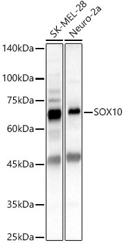 SOX10 Rabbit Polyclonal Antibody