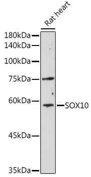 SOX10 Rabbit Polyclonal Antibody
