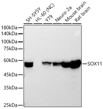 SOX11 Rabbit Monoclonal Antibody