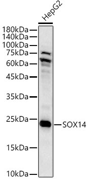 SOX14 Rabbit Polyclonal Antibody