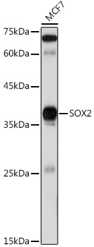 SOX2 Rabbit Polyclonal Antibody
