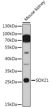 SOX21 Rabbit Polyclonal Antibody