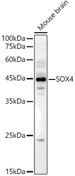 SOX4 Rabbit Polyclonal Antibody