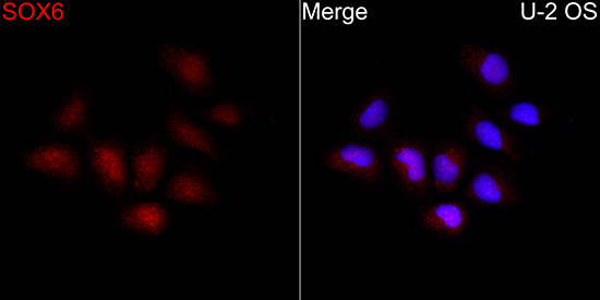 SOX6 Rabbit Polyclonal Antibody