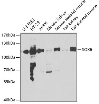 SOX6 Rabbit Polyclonal Antibody