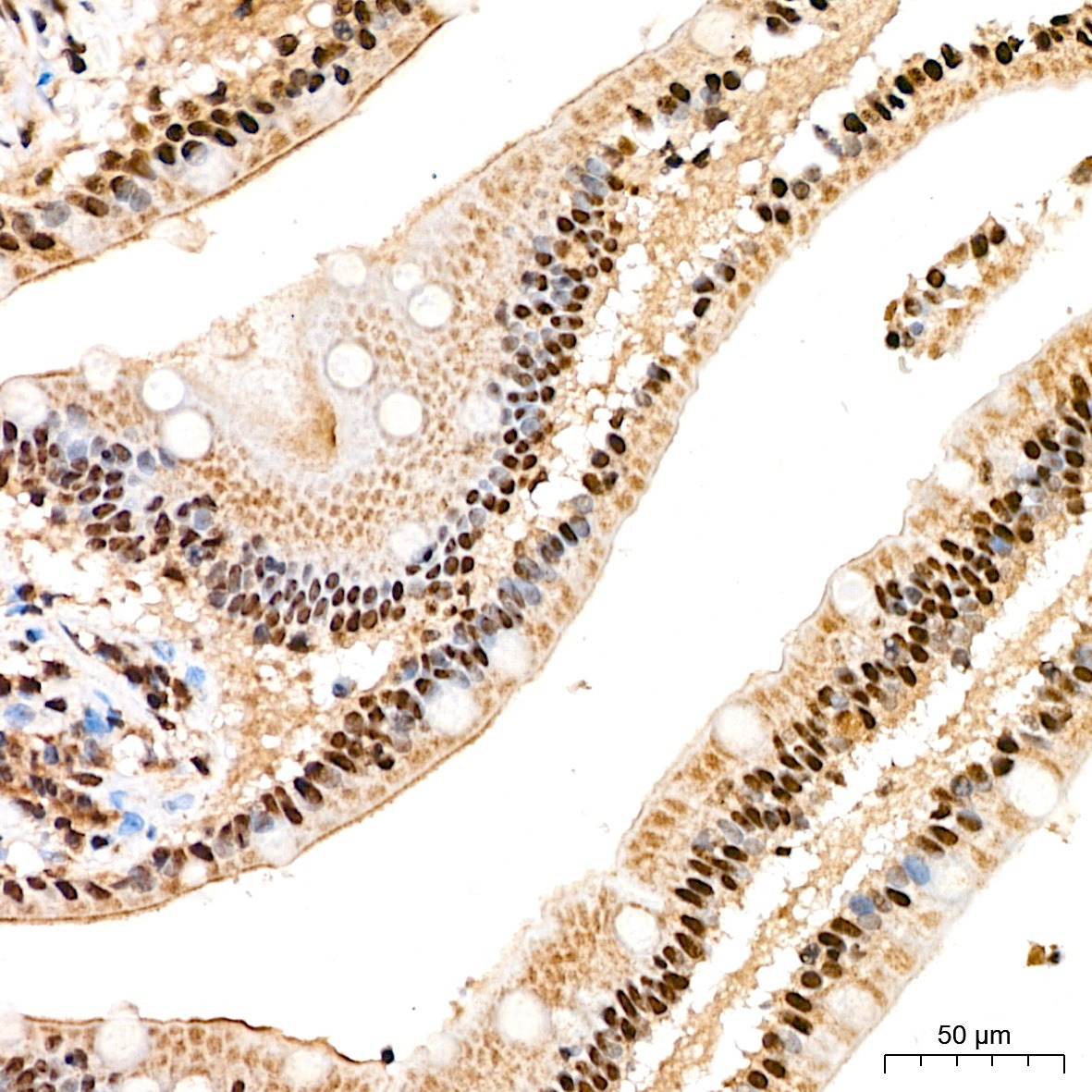 SP1 Rabbit Polyclonal Antibody