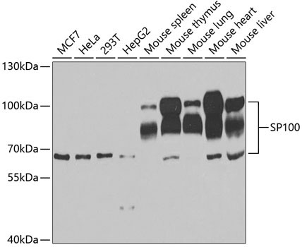 SP100 Rabbit Polyclonal Antibody