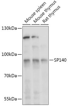 SP140 Rabbit Polyclonal Antibody