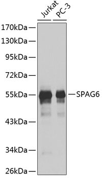 SPAG6 Rabbit Polyclonal Antibody
