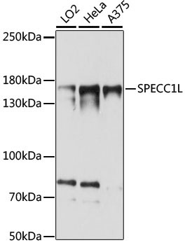 SPECC1L Rabbit Polyclonal Antibody