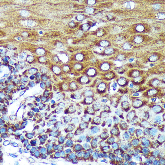 SPECC1L Rabbit Polyclonal Antibody - Image 2