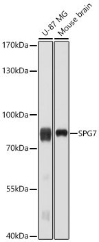 SPG7 Rabbit Polyclonal Antibody