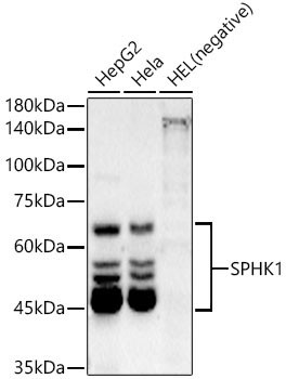 SPHK1 Rabbit Monoclonal Antibody
