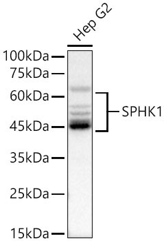 SPHK1 Rabbit Polyclonal Antibody
