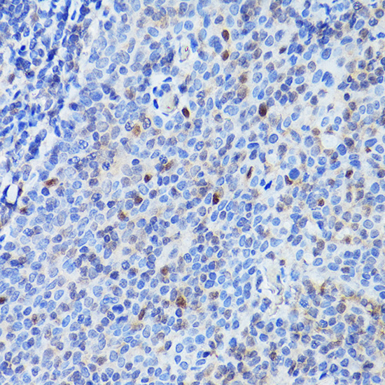 SPI1 Rabbit Polyclonal Antibody - Image 2