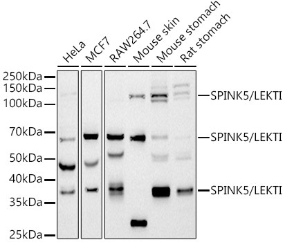 SPINK5 / LEKTI Rabbit Monoclonal Antibody