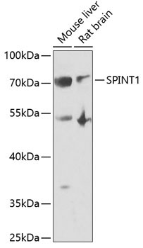 SPINT1 Rabbit Polyclonal Antibody