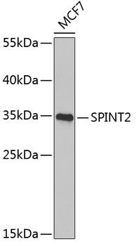 SPINT2 Rabbit Polyclonal Antibody