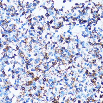 SPN Rabbit Polyclonal Antibody - Image 2