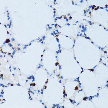 SPN Rabbit Polyclonal Antibody - Image 3