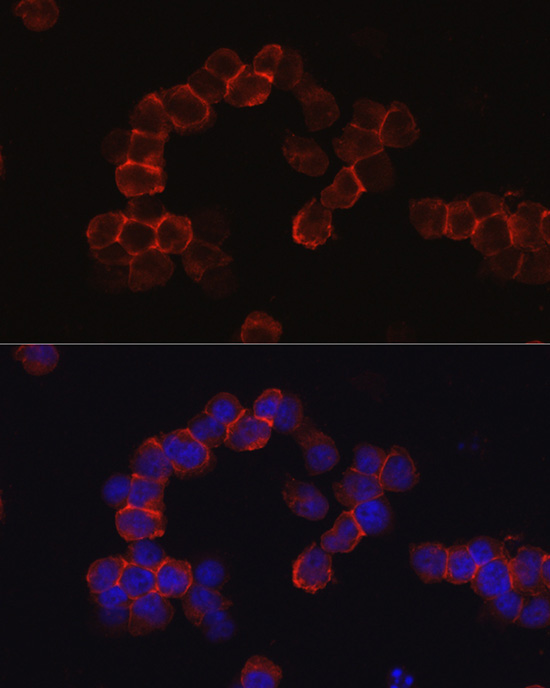 SPN Rabbit Polyclonal Antibody - Image 5