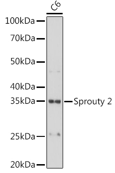 Sprouty 2 Rabbit Monoclonal Antibody