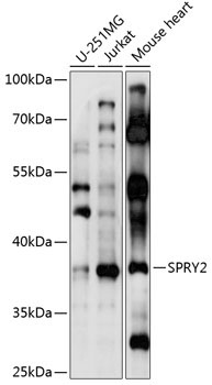 SPRY2 Rabbit Polyclonal Antibody