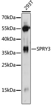 SPRY3 Rabbit Polyclonal Antibody