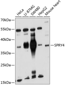 SPRY4 Rabbit Polyclonal Antibody