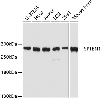 SPTBN1 Rabbit Polyclonal Antibody