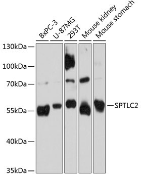 SPTLC2 Rabbit Polyclonal Antibody