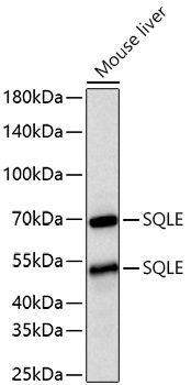 SQLE Rabbit Polyclonal Antibody