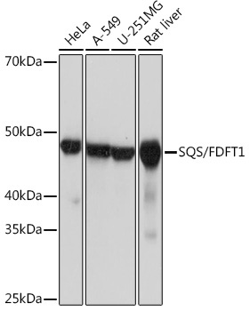 SQS/FDFT1 Rabbit Monoclonal Antibody